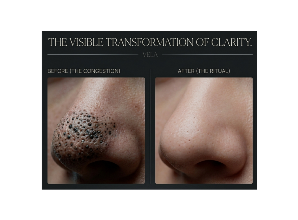 VELA Pore Clarifier — Manual Sebum & Blackhead Removal Tool