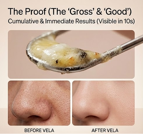 VELA Pore Clarifier — Manual Sebum & Blackhead Removal Tool